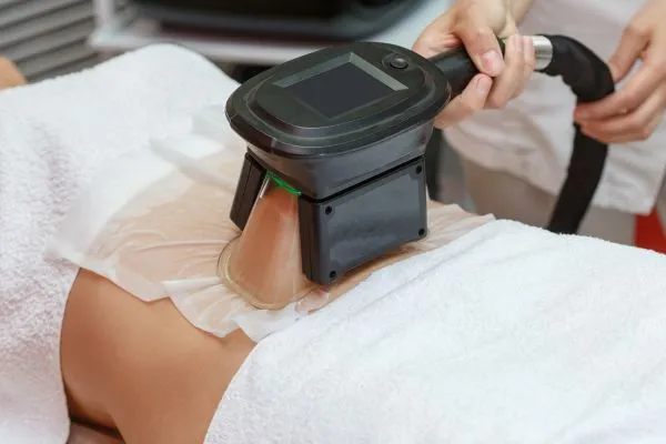 Image of person having fat freezing treatment to help weight gain Macclesfield