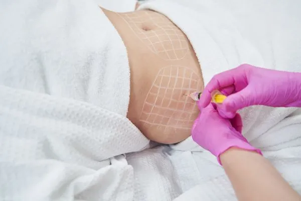 image of fat dissolving injections on love handles to help combat weight gain Macclesfield