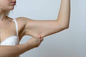 arm