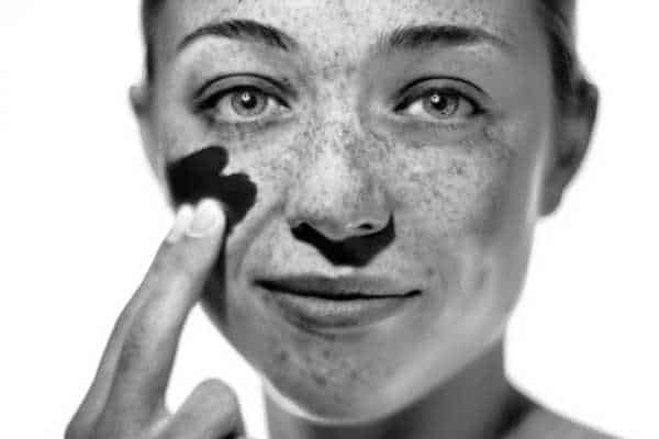 sun damage