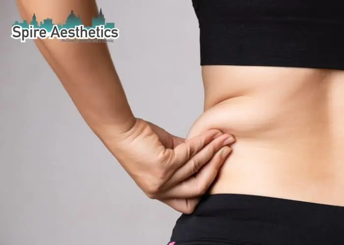 Image of woman pinching fat on their hips Macclesfield. Fat Freezing treatment