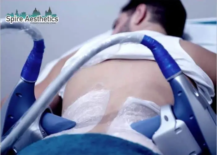Man having fat freezing treatment done on love handles before a competitions Macclesfield to create a sculpted look.
