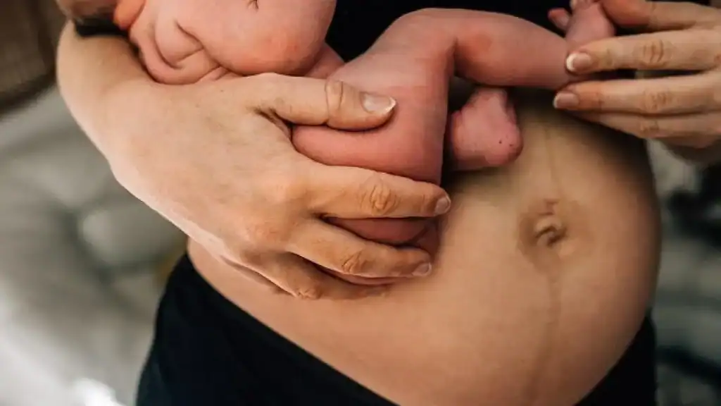 Why Is My Stomach Still Big After Pregnancy Macclesfield?