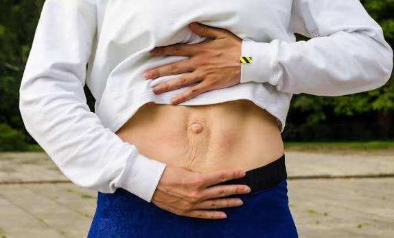 When Could Diastasis Recti Be the Missing Piece of the Puzzle Macclesfield?